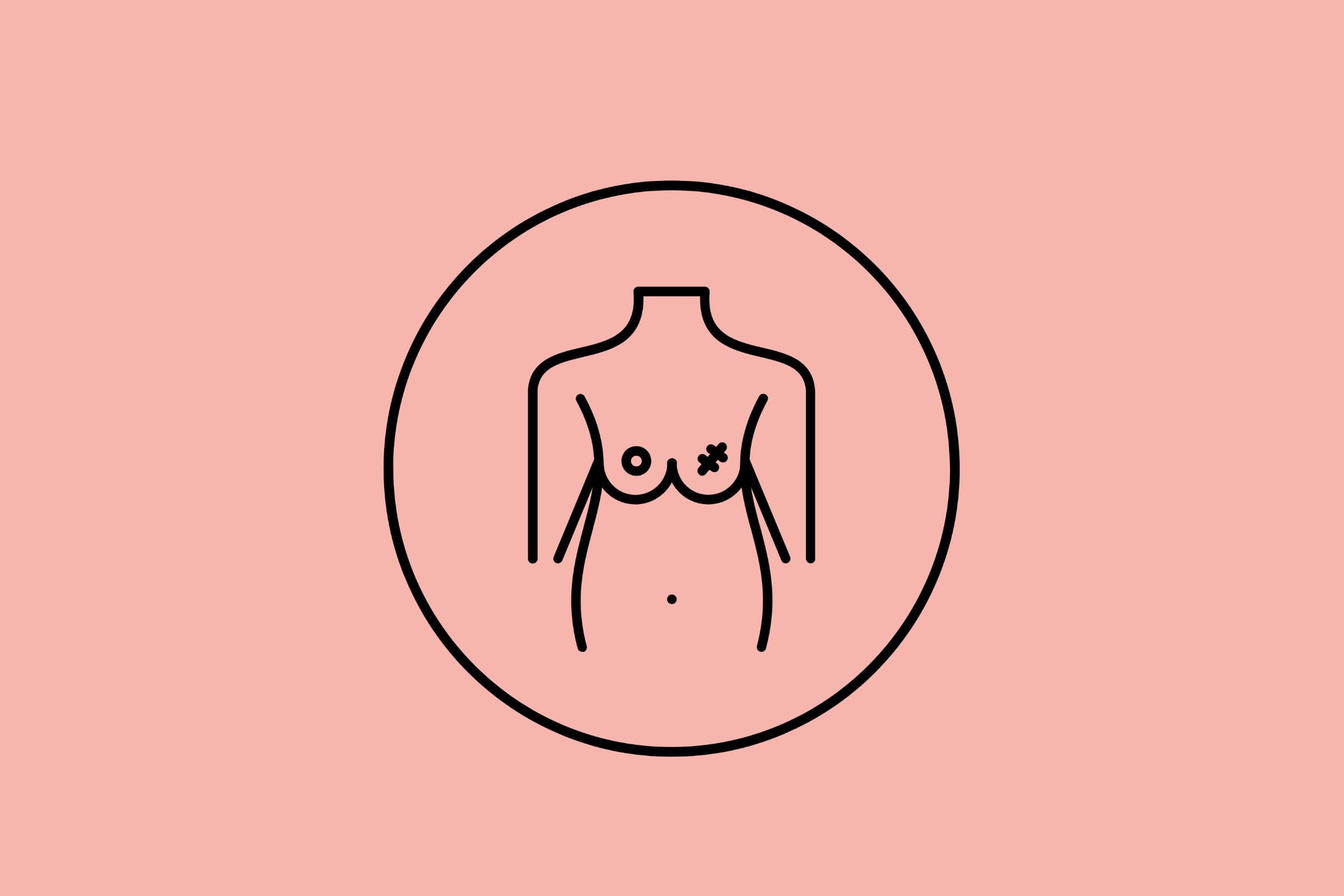 Breast Conservation Surgery