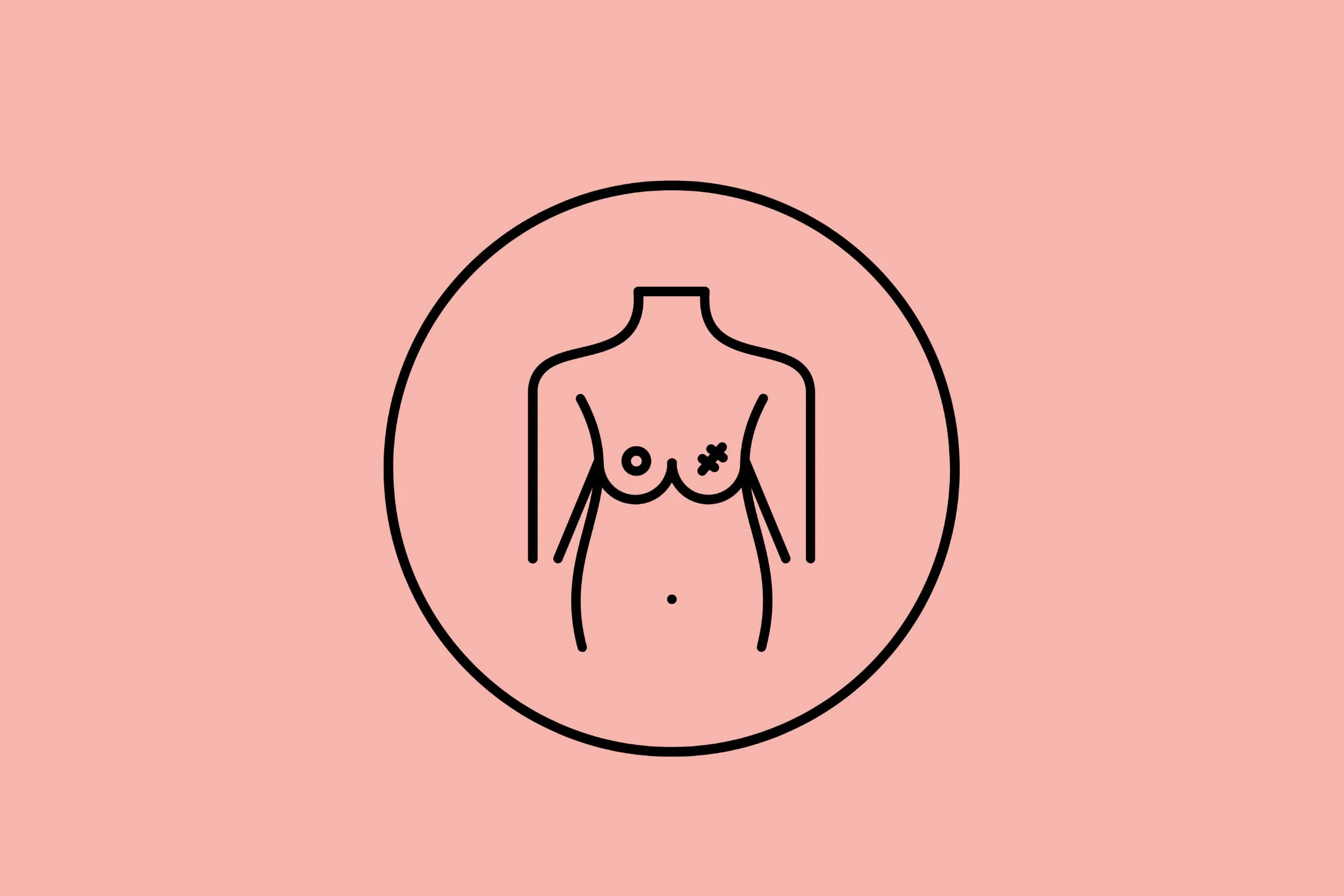 Breast Conservation Surgery